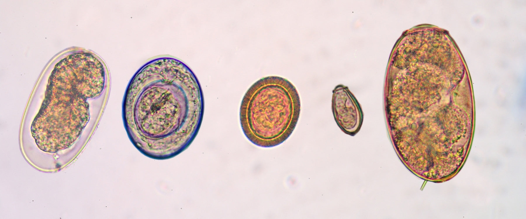 Wat merk je van parasieten in je darmen – en hoe kom je ervan af?